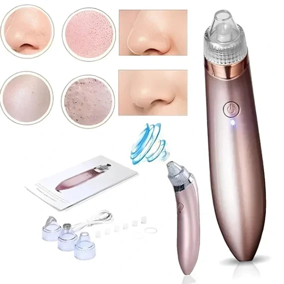 Electric Blackhead Acne Oil Remover & Vacuum Suction Face Pore Cleaner